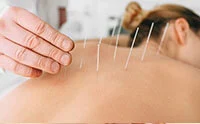 Акупунктура (ине терапиясы)